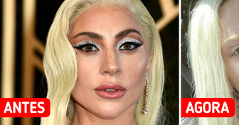"Parece ter 50 anos", Lady Gaga choca fãs com sua nova aparência