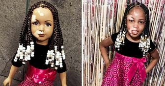 Artista reforça a autoestima de meninas com vitiligo criando bonecas especialmente para elas