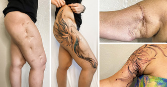 Artista tatua cicatrizes para que as pessoas possam exibir o que antes escondiam