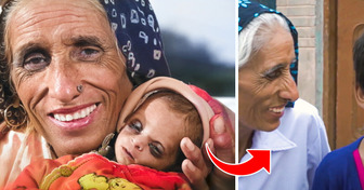 Antes e depois da menina que nasceu quando sua mãe já tinha 70 anos