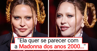 O rosto incrivelmente jovem de Madonna no Grammy deixa todos atordoados, e uma fonte próxima revela por que ela está mudando suas características