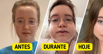 Cantora viaja 24 horas para fazer cirurgia na mandíbula e reaparece irreconhecível
