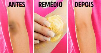 10 Remédios naturais para clarear a pele dos joelhos e cotovelos