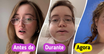 Cantora revela como a cirurgia de mandíbula dupla mexeu com sua autoestima e rotina