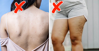 8 Efeitos não óbvios para a saúde decorrentes do uso de roupas muito justas
