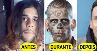 Brasileiro com 95% do corpo tatuado mostra transformação impressionante após remoção a laser