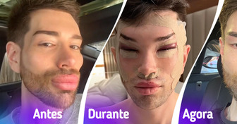 Ex-Ken Humano surpreende ao abandonar aparência plástica e adotar novo visual