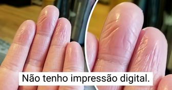 20 Pessoas que descobriram algo único sobre seus corpos