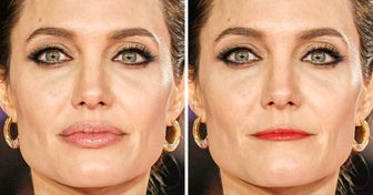 17 Fotos mostram como um ajuste nos lábios pode mudar totalmente o rosto