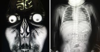 19 Imagens bizarras de raios X para quem acha que já viu de tudo (nada supera a do Bob Esponja)