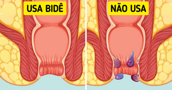 Trocar o papel higiênico por um bidê pode melhorar sua saúde íntima