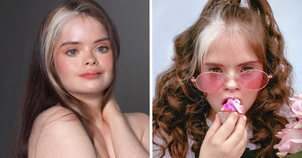 Jessica, uma modelo com síndrome de Down, promove a beleza não estereotipada