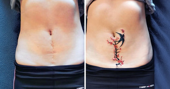 20+ Tatuagens que ajudaram pessoas a ressignificar suas cicatrizes
