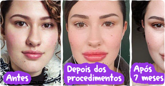 15+ Mulheres que abraçaram a beleza natural e deixaram as pressões da moda para trás