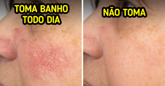 Os mitos sobre o banho diário e o que ninguém te conta sobre esse hábito