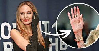 Aparição de Angelina Jolie no tapete vermelho gera preocupação