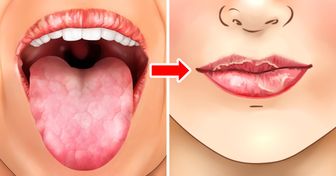 Por que nossos lábios ficam ressecados (e algumas dicas para evitar o problema)