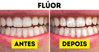 10 Produtos que causam danos irreparáveis aos seus dentes