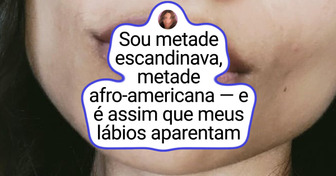 15 Pessoas com traços tão raros que quebram padrões e prendem o olhar