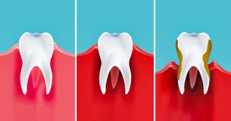 O que acontece com seus dentes quando você deixa de escová-los à noite (e algumas dicas para sua saúde bucal)