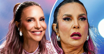 18 Closes em famosos que provam que a perfeição não existe de verdade