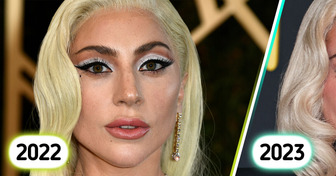 “Ela precisa deixar seu rosto em paz”, a última aparição de Lady Gaga gera polêmica