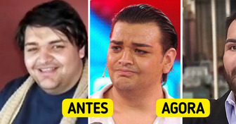 Obcecado por Ricky Martin, homem transforma o rosto com dezenas de cirurgias