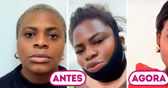 Transformação no rosto de Jojo Todynho gera debate nas redes sociais