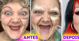 Intolerante a laticínios, ela perdeu os dentes aos 38 anos, mas sua transformação é admirável