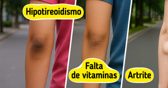 10 Sintomas que seu cotovelo está tentando te contar sobre o seu corpo