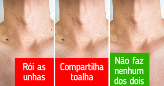 7 Maneiras eficazes de evitar o surgimento de verrugas
