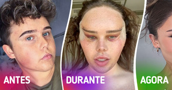 Influenciadora trans mostra sua árdua jornada para obter "olhos de raposa"