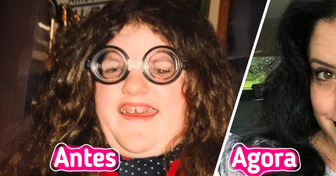 16 Pessoas compartilham fotos marcantes que mostram de verdade o que é uma transformação