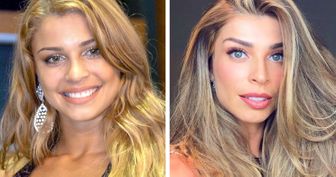 20 Celebridades brasileiras para questionar se a fama deixa as pessoas mais bonitas