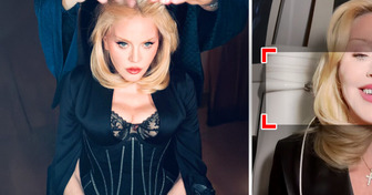 Madonna mostrou os novos dentes e a maioria reparou na mesma coisa