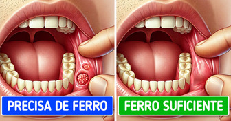 7 Sinais do seu corpo que podem indicar algo sério