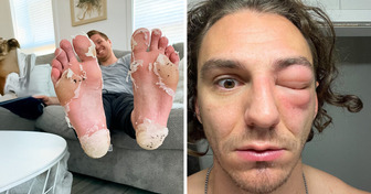 19 Pessoas que levaram um tombo da vida e ainda assim conseguiram rir na queda
