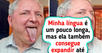 15 Traços corporais raros que mostram como a natureza adora surpreender