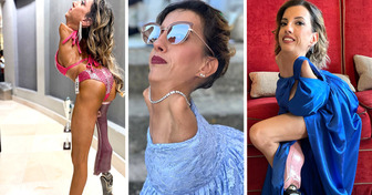 Mesmo com uma condição rara, ela desafiou rótulos e virou inspiração para muita gente
