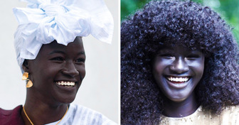 Conheça Khoudia Diop, modelo com um tom de pele único que transformou a negatividade em inspiração para celebrar sua beleza