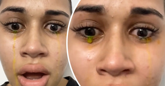 Mulher compartilha um vídeo de seu choro amarelo e desperta preocupação pública