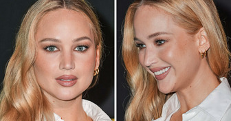 “O que aconteceu com o rosto dela?” A última aparição de Jennifer Lawrence gerou certa controvérsia