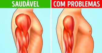 A degeneração muscular começa com 8 sintomas. Saiba quais são