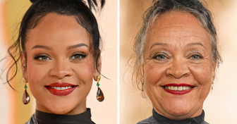 Como 12 celebridades envelheceriam sem procedimentos cosméticos