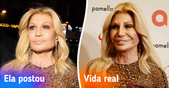 17 Fotos que mostram o lado real das celebridades por trás das edições