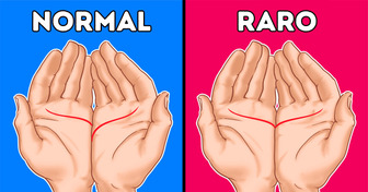 10 Características corporais que só uma minoria da população possui