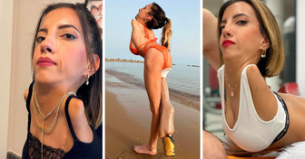 Sem braços e uma perna, mulher desafia limites e transforma vidas com seu exemplo