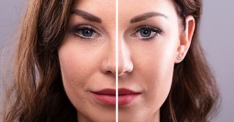 Um treino de 9 etapas que ajuda a tonificar e eliminar rugas da face