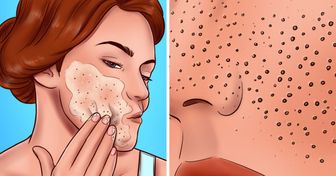 8 Erros no cuidado com a pele que deixam os poros dilatados