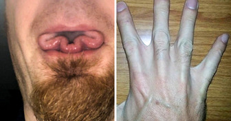14 Traços raros do corpo humano que certamente fazem seus donos se destacarem
